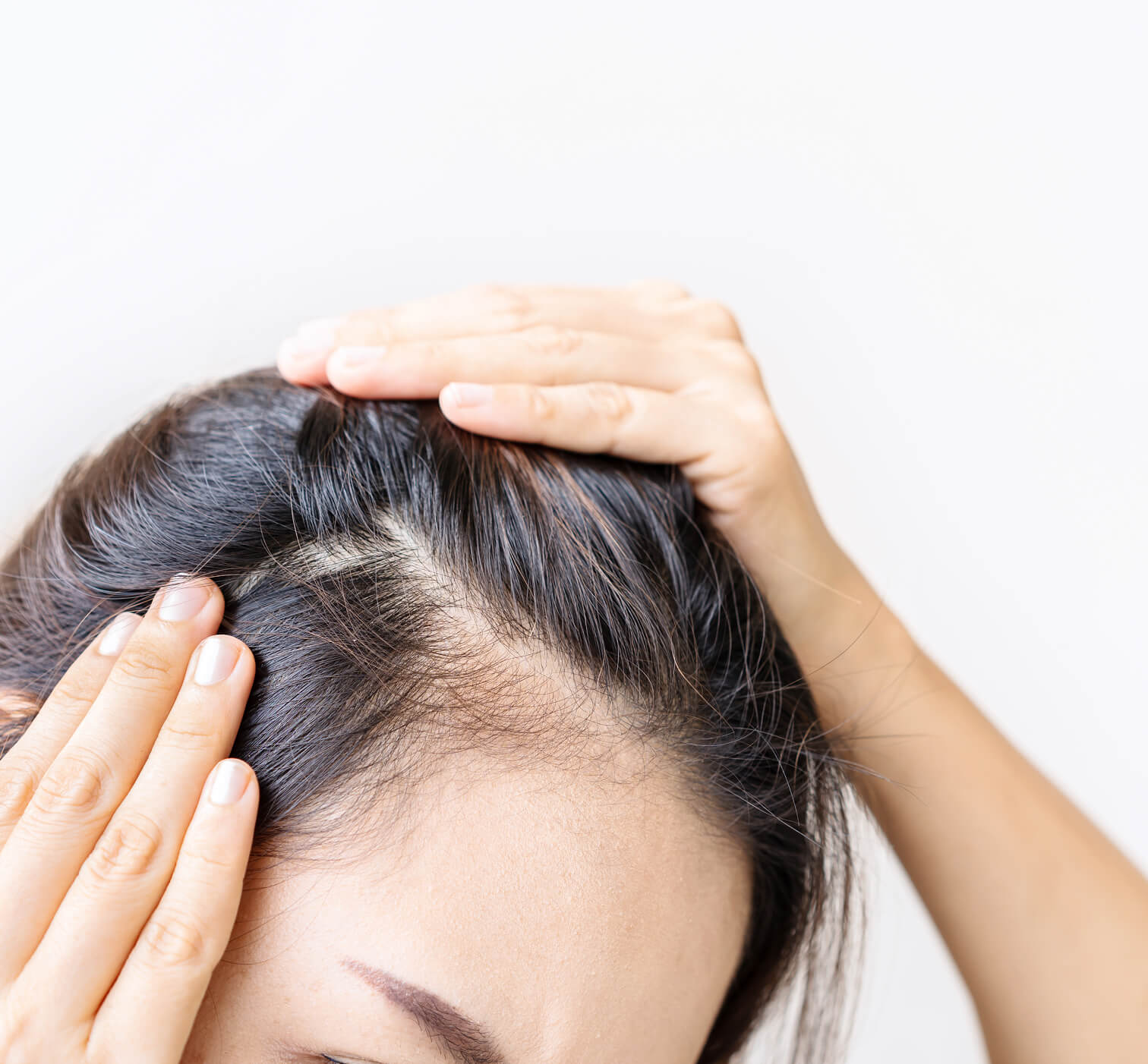Person parting dark hair to reveal the scalp, illustrating dry and itchy scalp concerns.