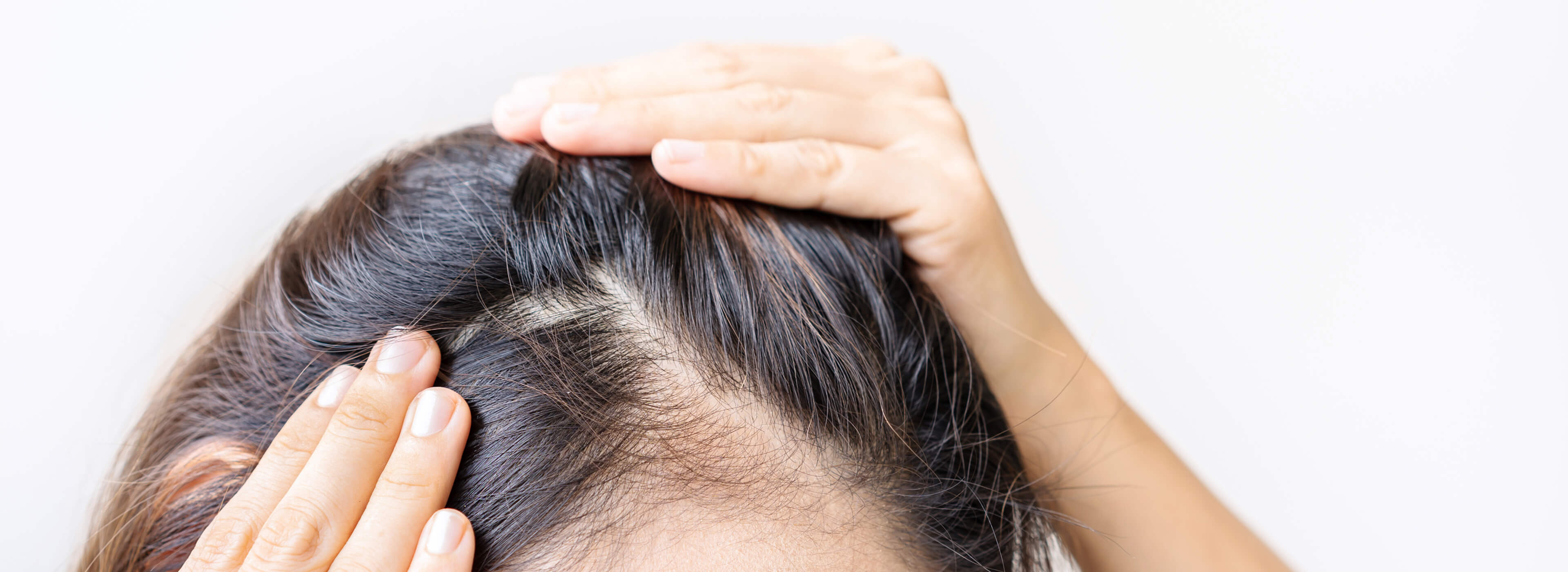 Person parting dark hair to reveal the scalp, illustrating dry and itchy scalp concerns.