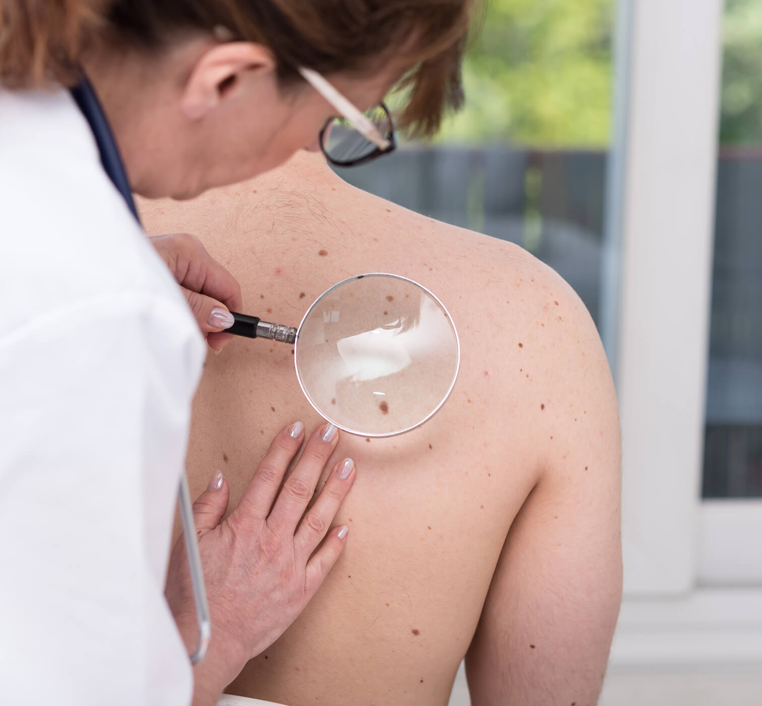 Dermatologist examining a patient's back for moles and sun damage during a skin cancer screening.