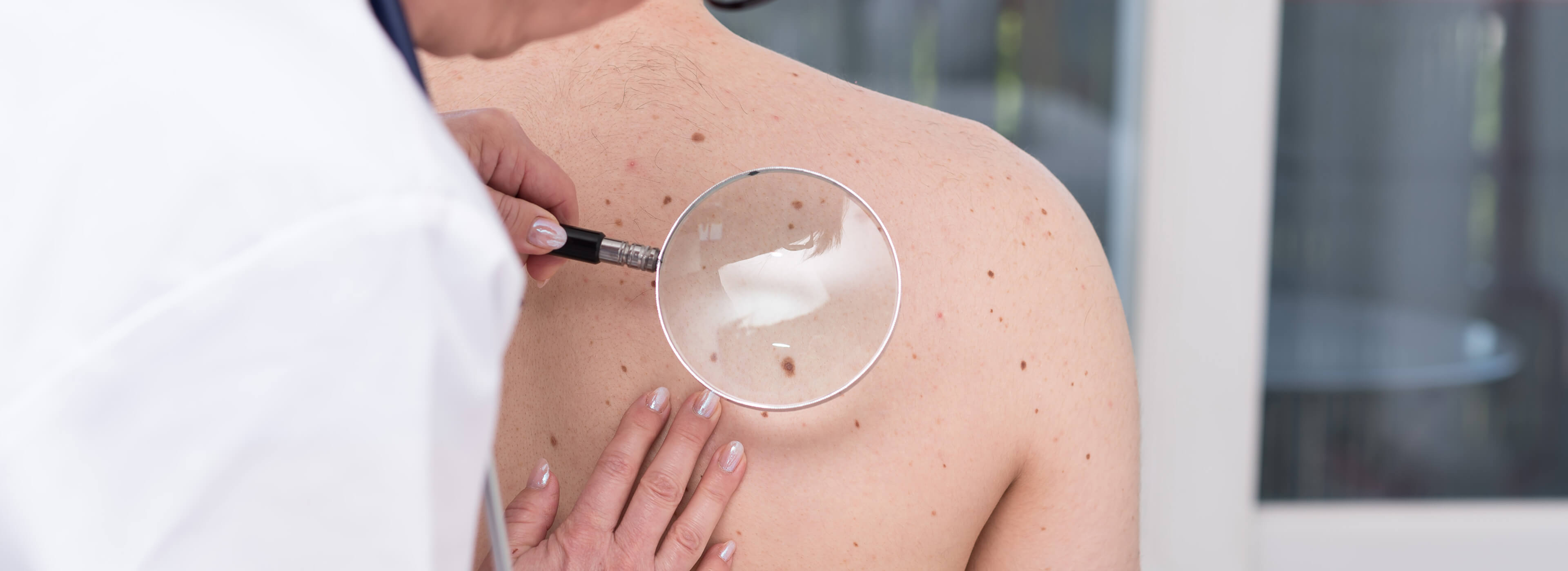 Dermatologist examining a patient's back for moles and sun damage during a skin cancer screening.